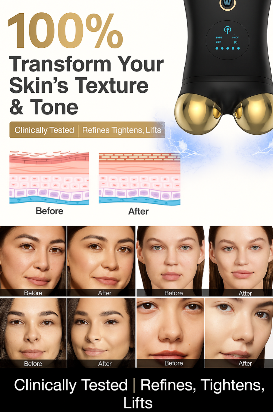 Nuovaluce Anti Aging Pro Device