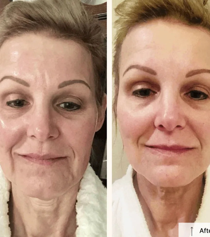 Before and after result